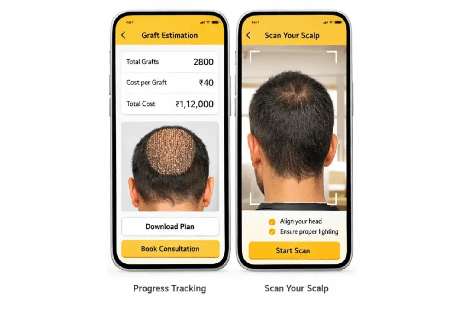 Automated Graft Estimation and Pricing Engine With Clinic Defined Parameters