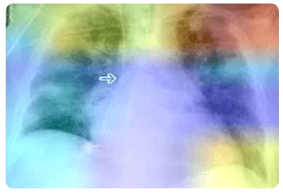 AI Diagnostic System