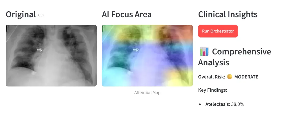 AI Powered Medical Diagnostic System